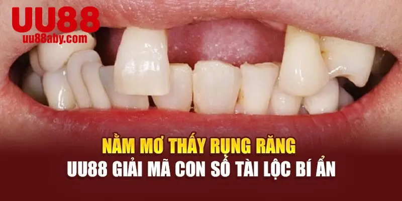Nằm Mơ Thấy Rụng Răng - UU88 Giải Mã Con Số Tài Lộc Bí Ẩn